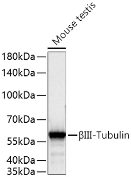 [KD Validated] βIII-Tubulin Rabbit mAb