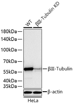 [KD Validated] βIII-Tubulin Rabbit mAb