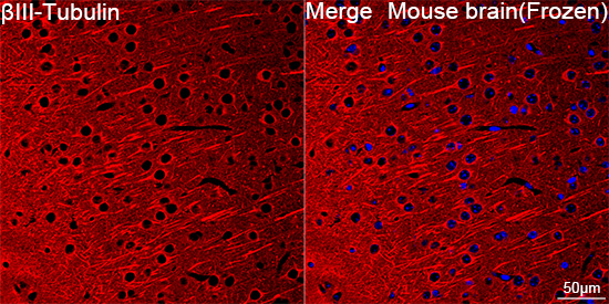 [KD Validated] βIII-Tubulin Rabbit mAb