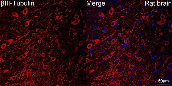 βIII-Tubulin Rabbit mAb