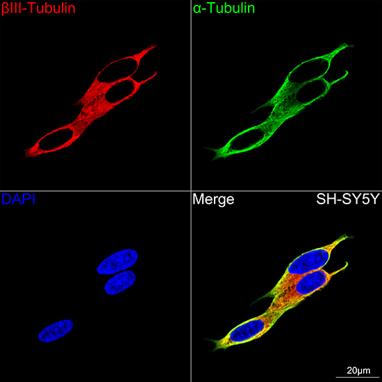 [KD Validated] βIII-Tubulin Rabbit mAb
