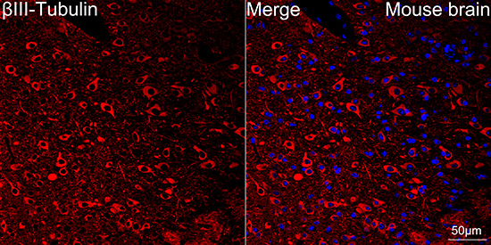 [KD Validated] βIII-Tubulin Rabbit mAb