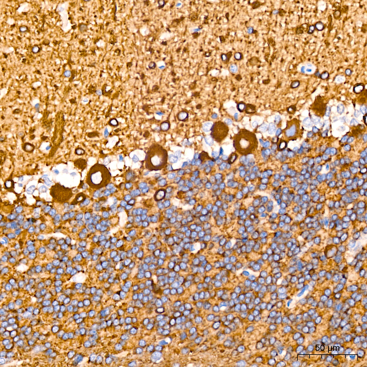 [KD Validated] βIII-Tubulin Rabbit mAb