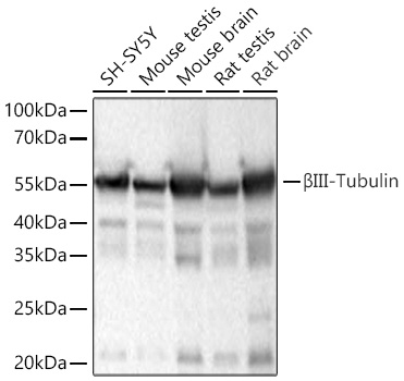 βIII-Tubulin Rabbit mAb