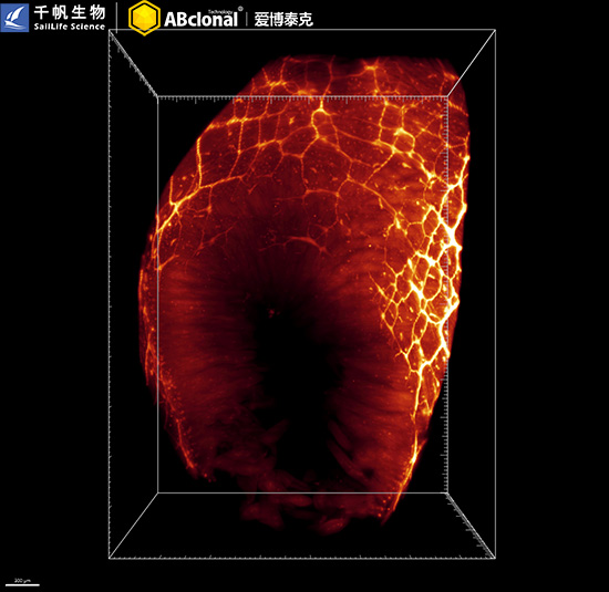 [KD Validated] βIII-Tubulin Rabbit mAb