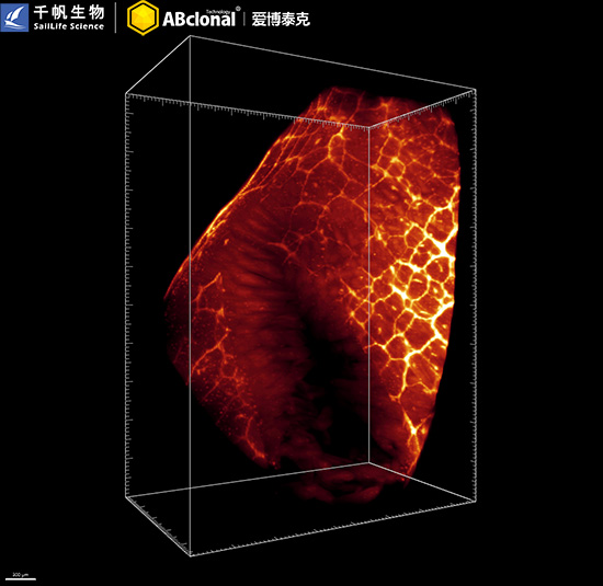 [KD Validated] βIII-Tubulin Rabbit mAb