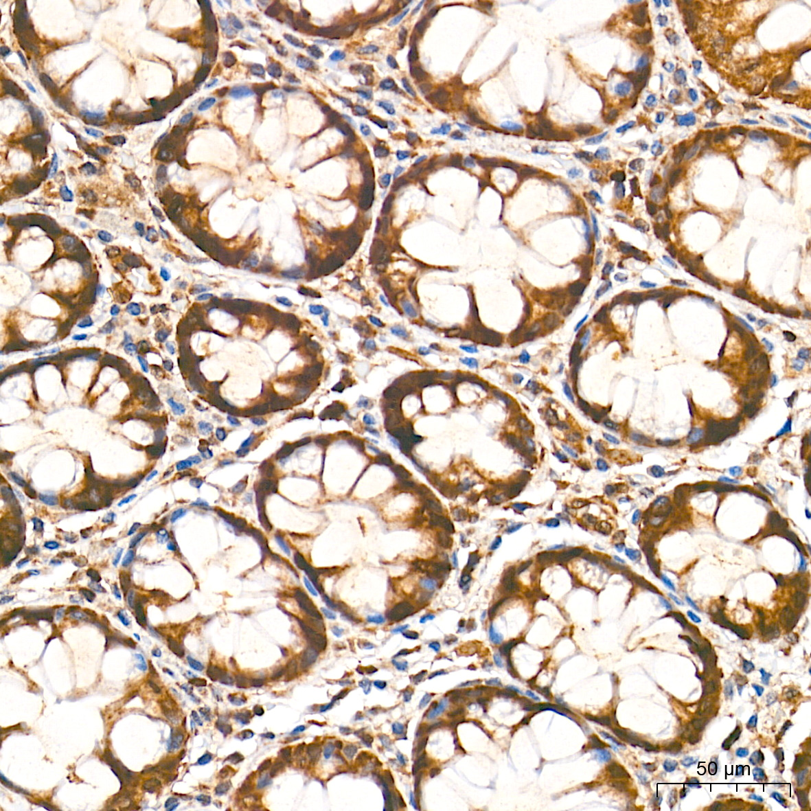 [KO Validated] Bax Rabbit mAb