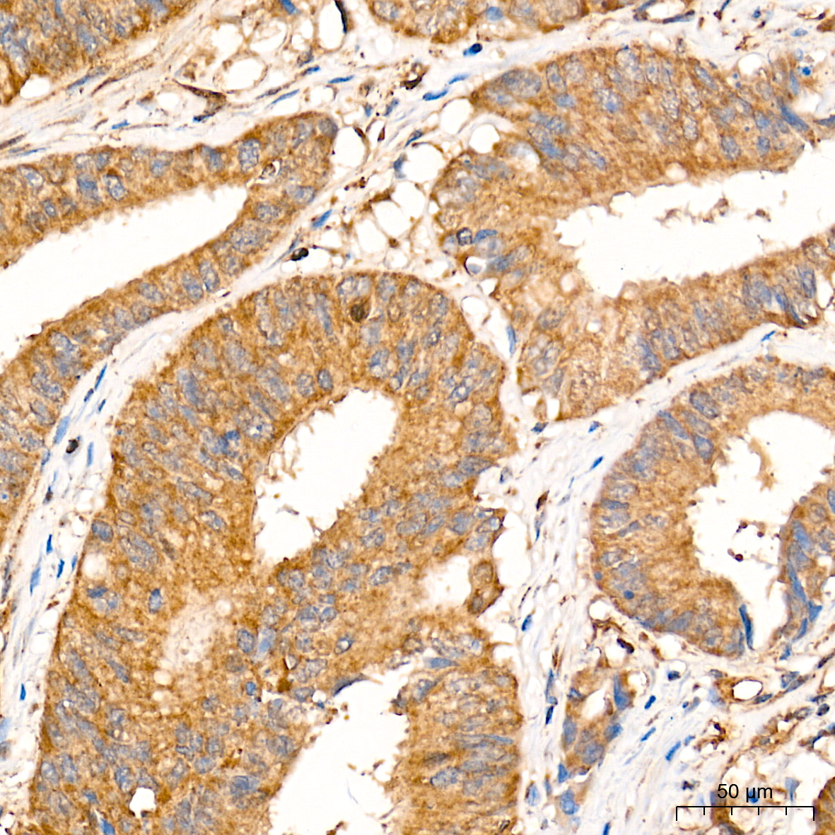 [KO Validated] Bax Rabbit mAb