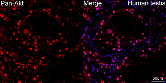 Pan-Akt Rabbit mAb