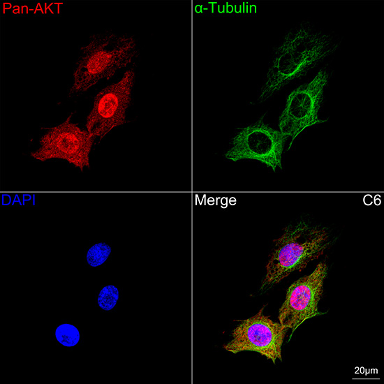 Pan-Akt Rabbit mAb