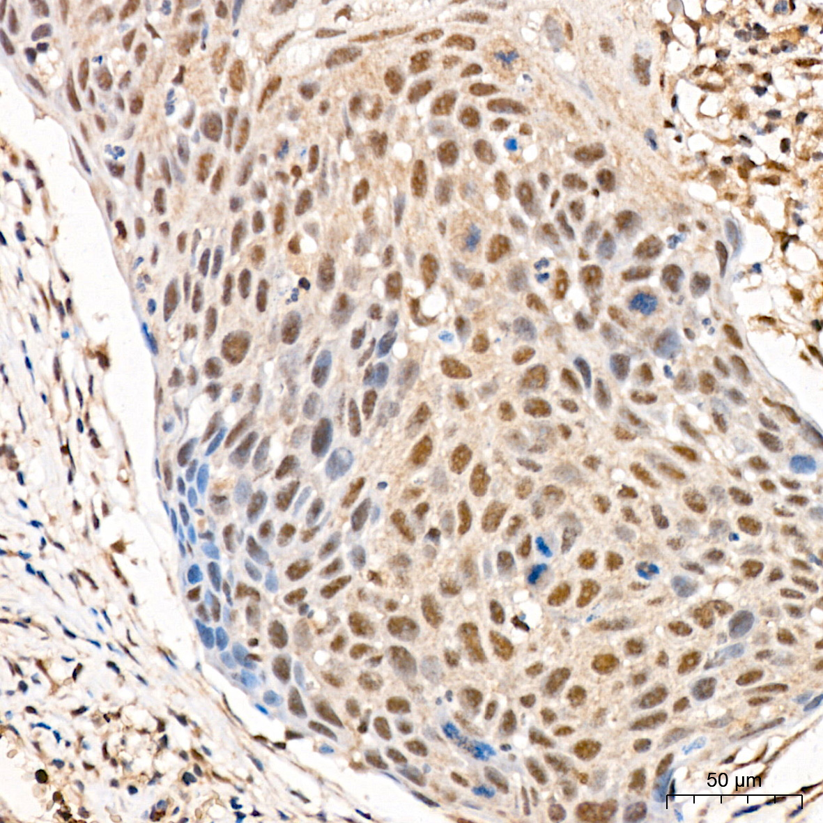 Pan-Akt Rabbit mAb