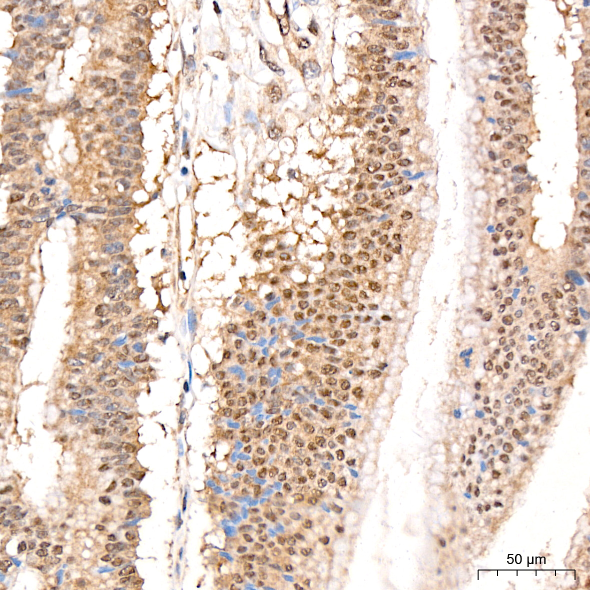 Pan-Akt Rabbit mAb