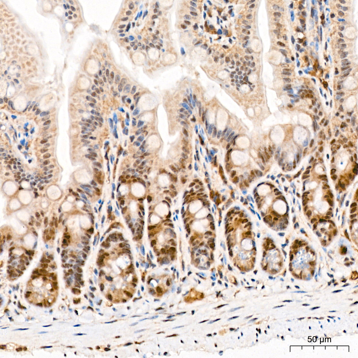 Pan-Akt Rabbit mAb