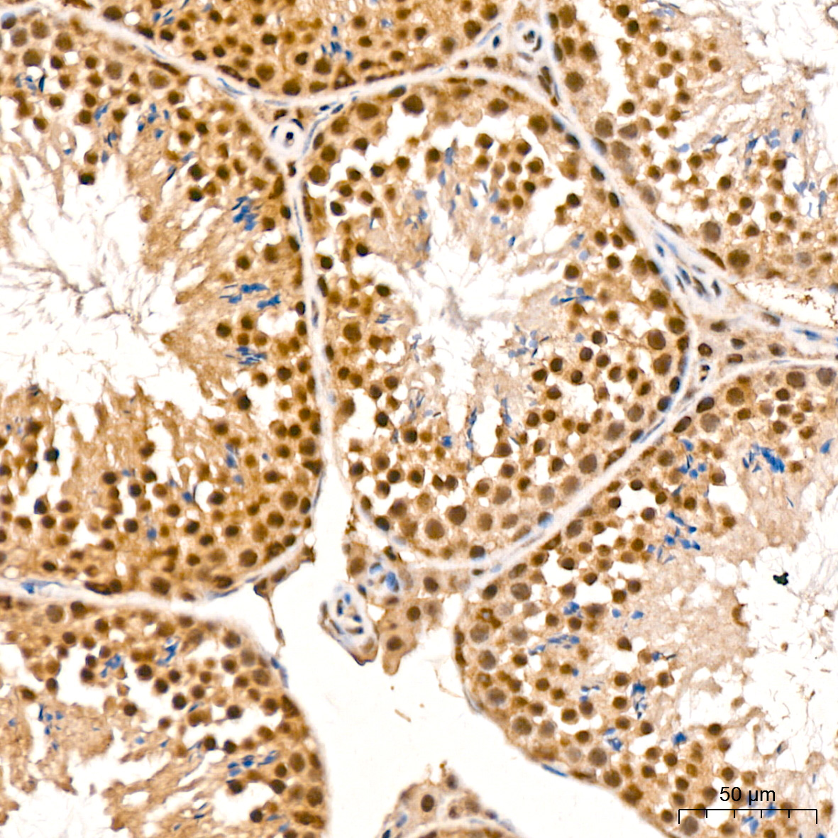 Pan-Akt Rabbit mAb