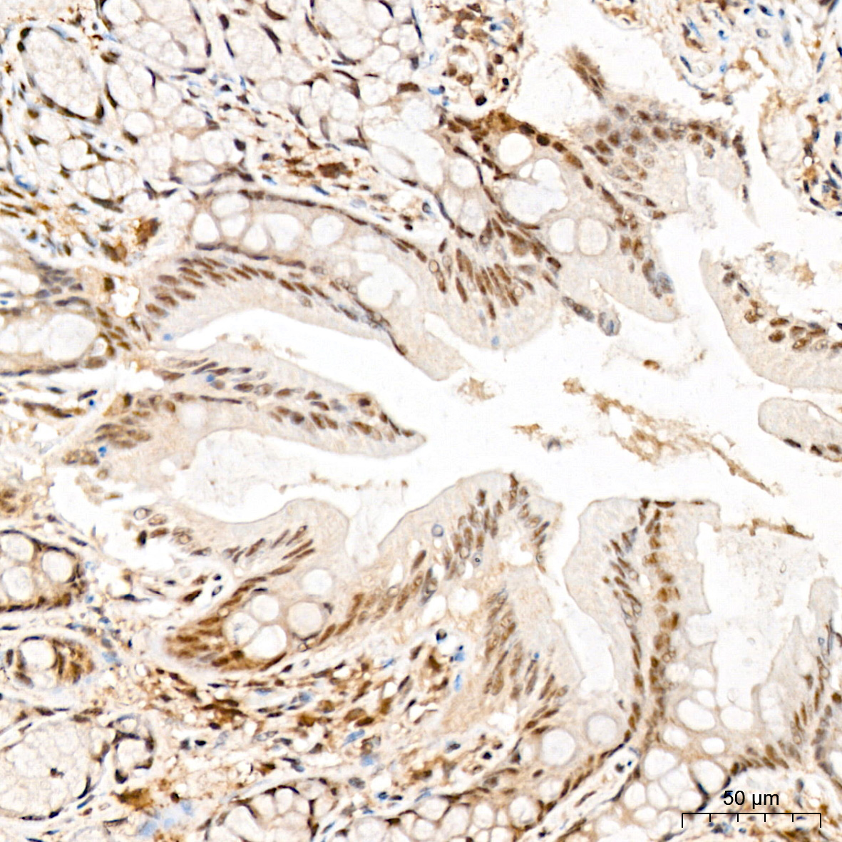 Pan-Akt Rabbit mAb