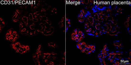 CD31/PECAM1 Rabbit mAb