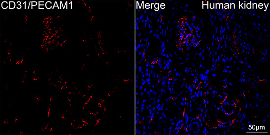 CD31/PECAM1 Rabbit mAb