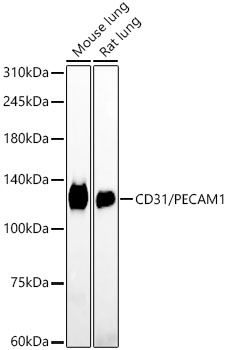 CD31/PECAM1 Rabbit mAb