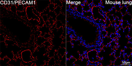 CD31/PECAM1 Rabbit mAb