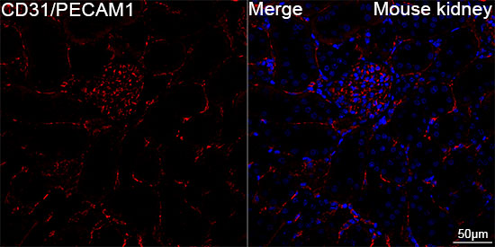 CD31/PECAM1 Rabbit mAb