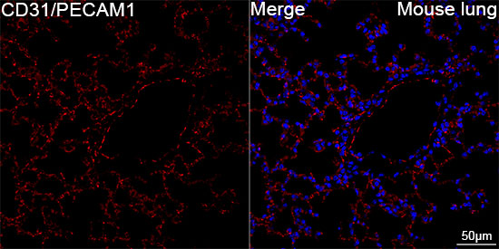 CD31/PECAM1 Rabbit mAb