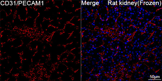 CD31/PECAM1 Rabbit mAb