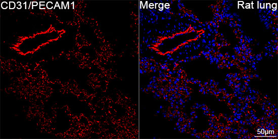 CD31/PECAM1 Rabbit mAb