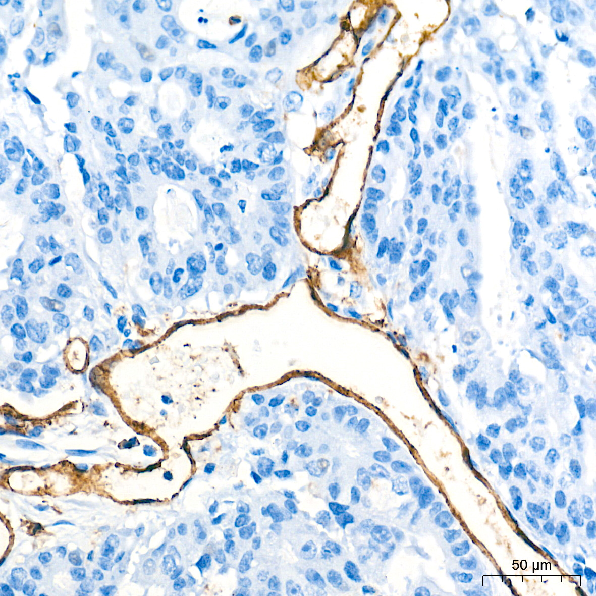 CD31/PECAM1 Rabbit mAb