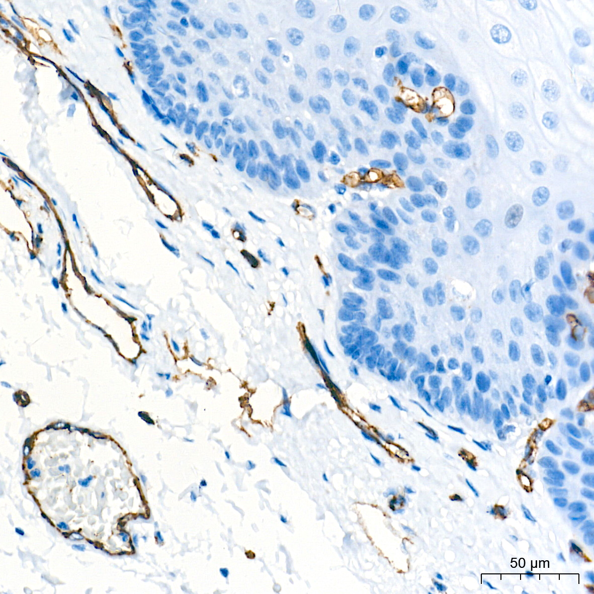 CD31/PECAM1 Rabbit mAb