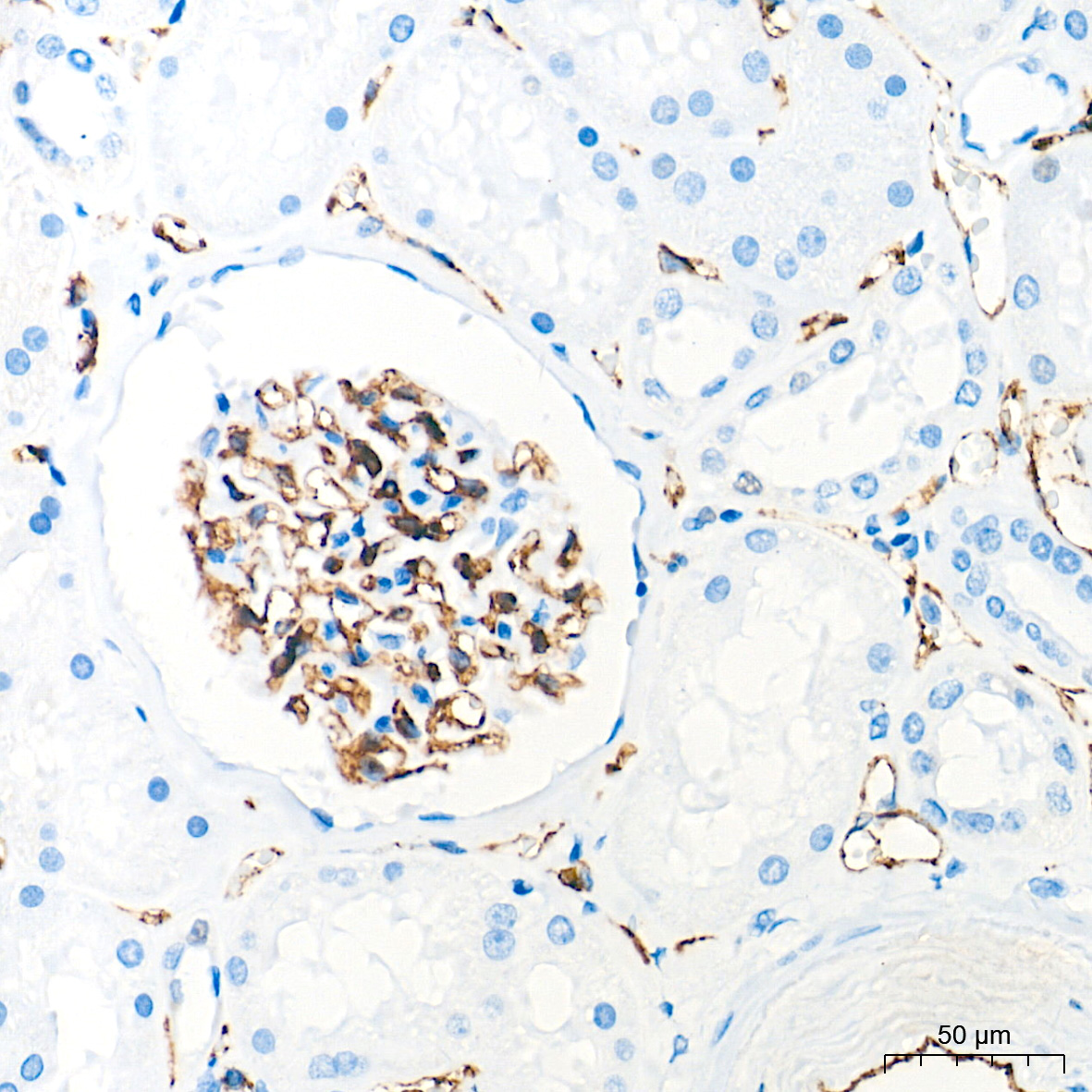 CD31/PECAM1 Rabbit mAb