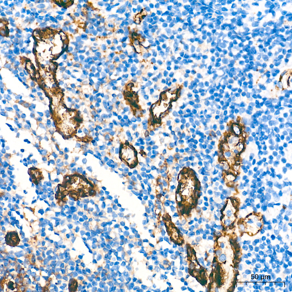 CD31/PECAM1 Rabbit mAb