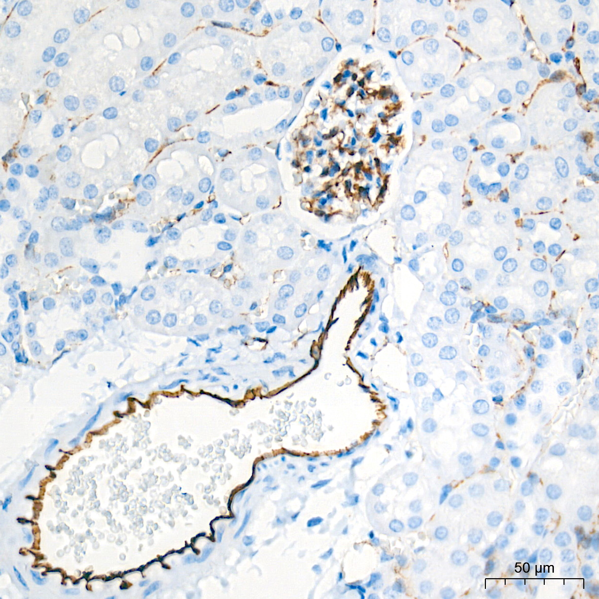 CD31/PECAM1 Rabbit mAb