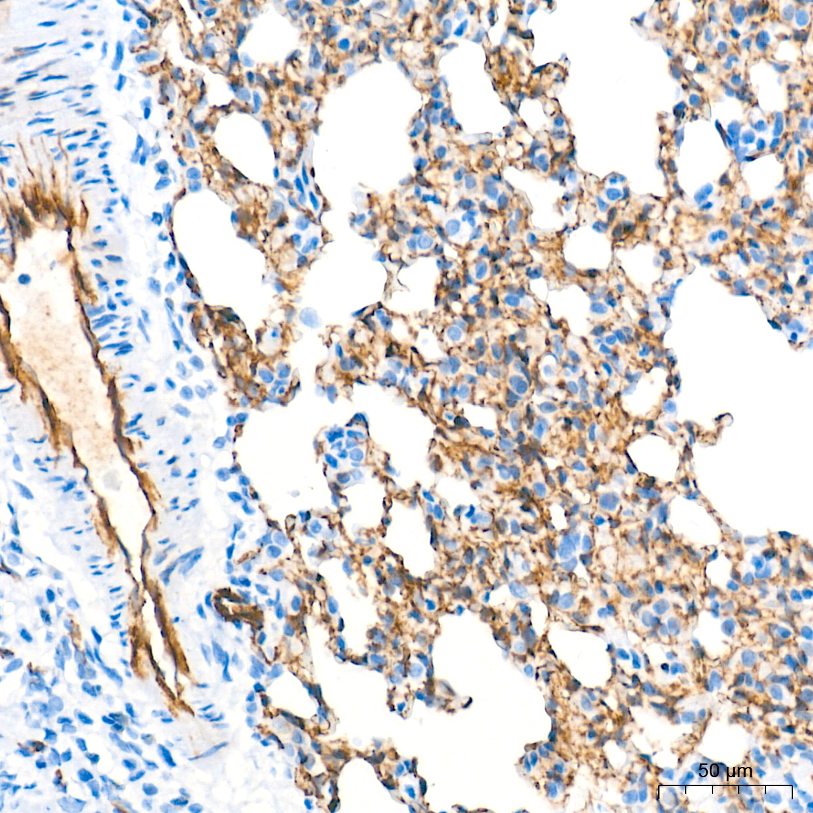 CD31/PECAM1 Rabbit mAb