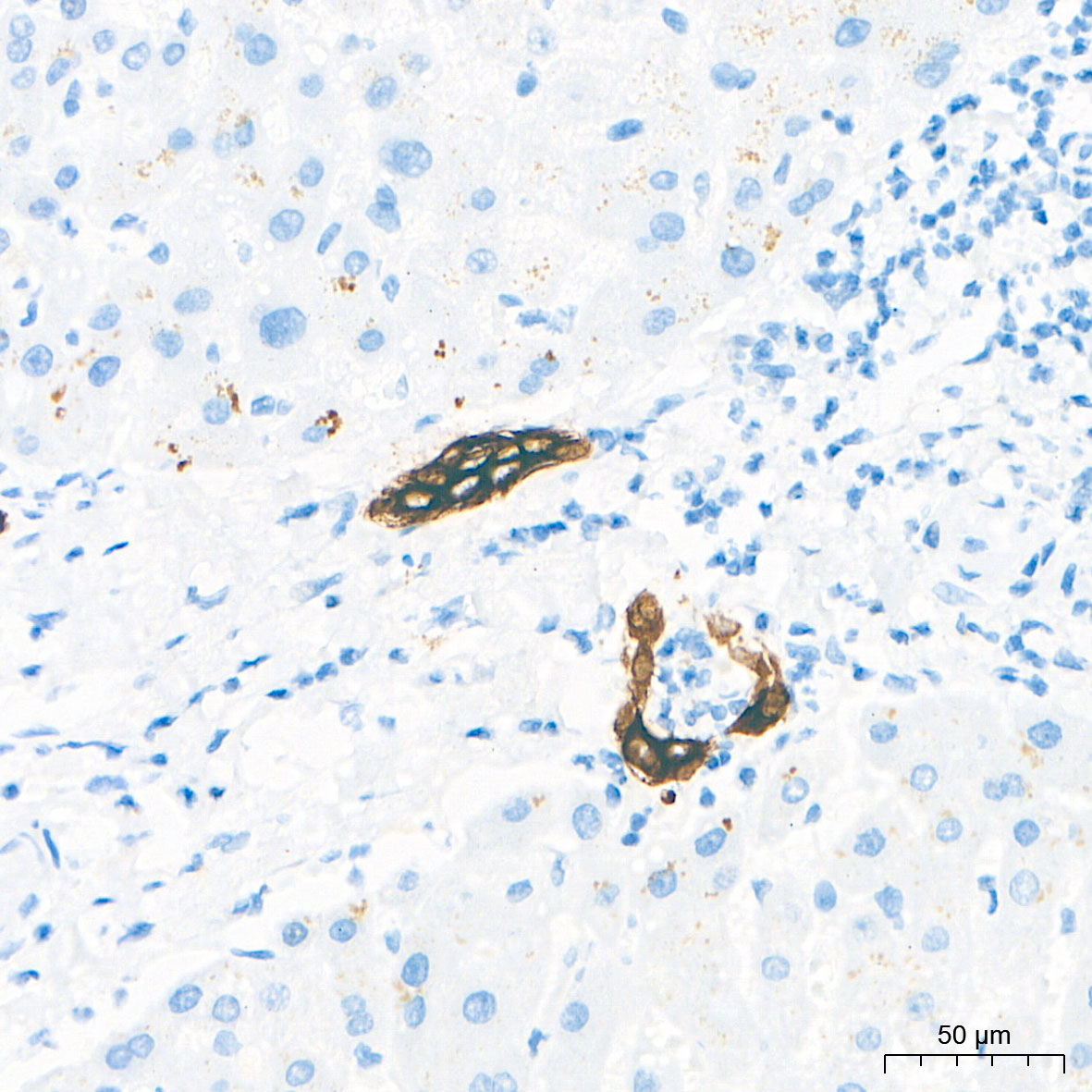 Cytokeratin 19 (CK19) Rabbit mAb
