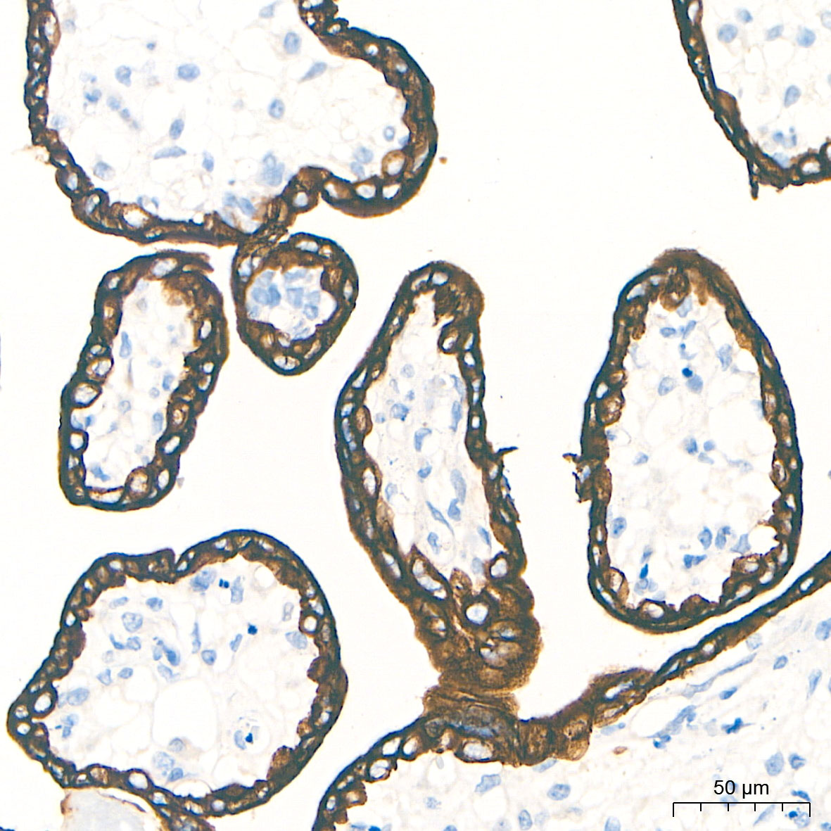 Cytokeratin 19 (CK19) Rabbit mAb