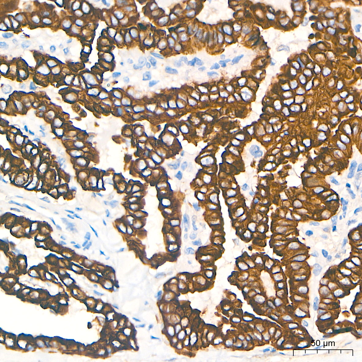 Cytokeratin 19 (CK19) Rabbit mAb