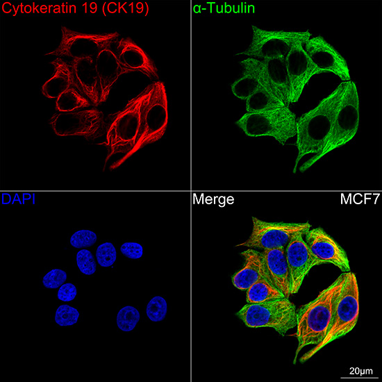 Cytokeratin 19 (CK19) Rabbit mAb