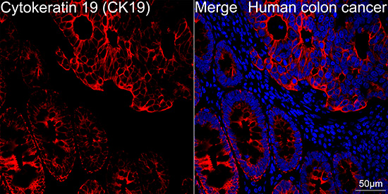 Cytokeratin 19 (CK19) Rabbit mAb