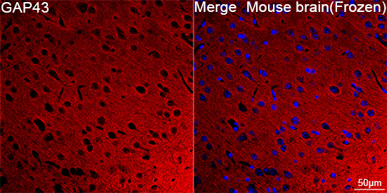 GAP43 Rabbit mAb