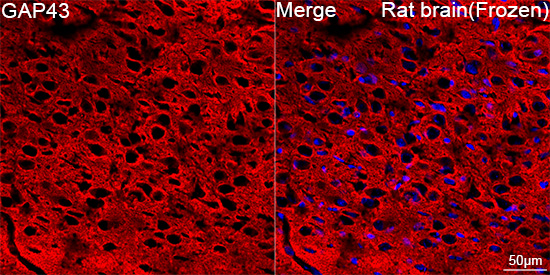 GAP43 Rabbit mAb