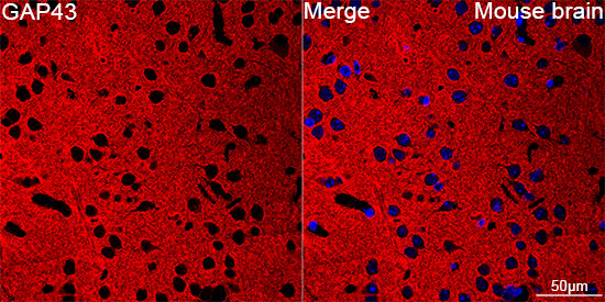 GAP43 Rabbit mAb