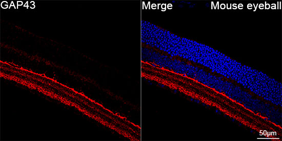 GAP43 Rabbit mAb