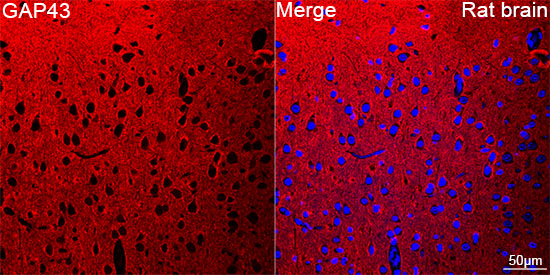 GAP43 Rabbit mAb