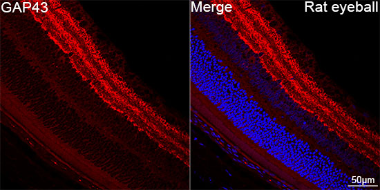 GAP43 Rabbit mAb