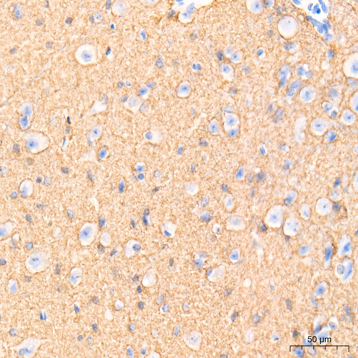 GAP43 Rabbit mAb