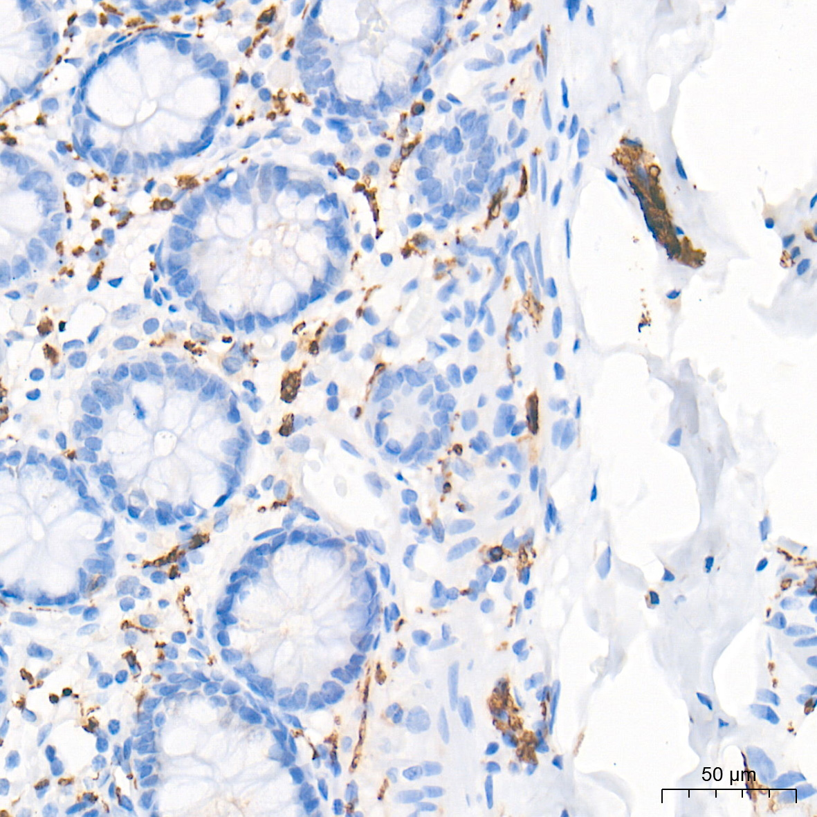 GAP43 Rabbit mAb