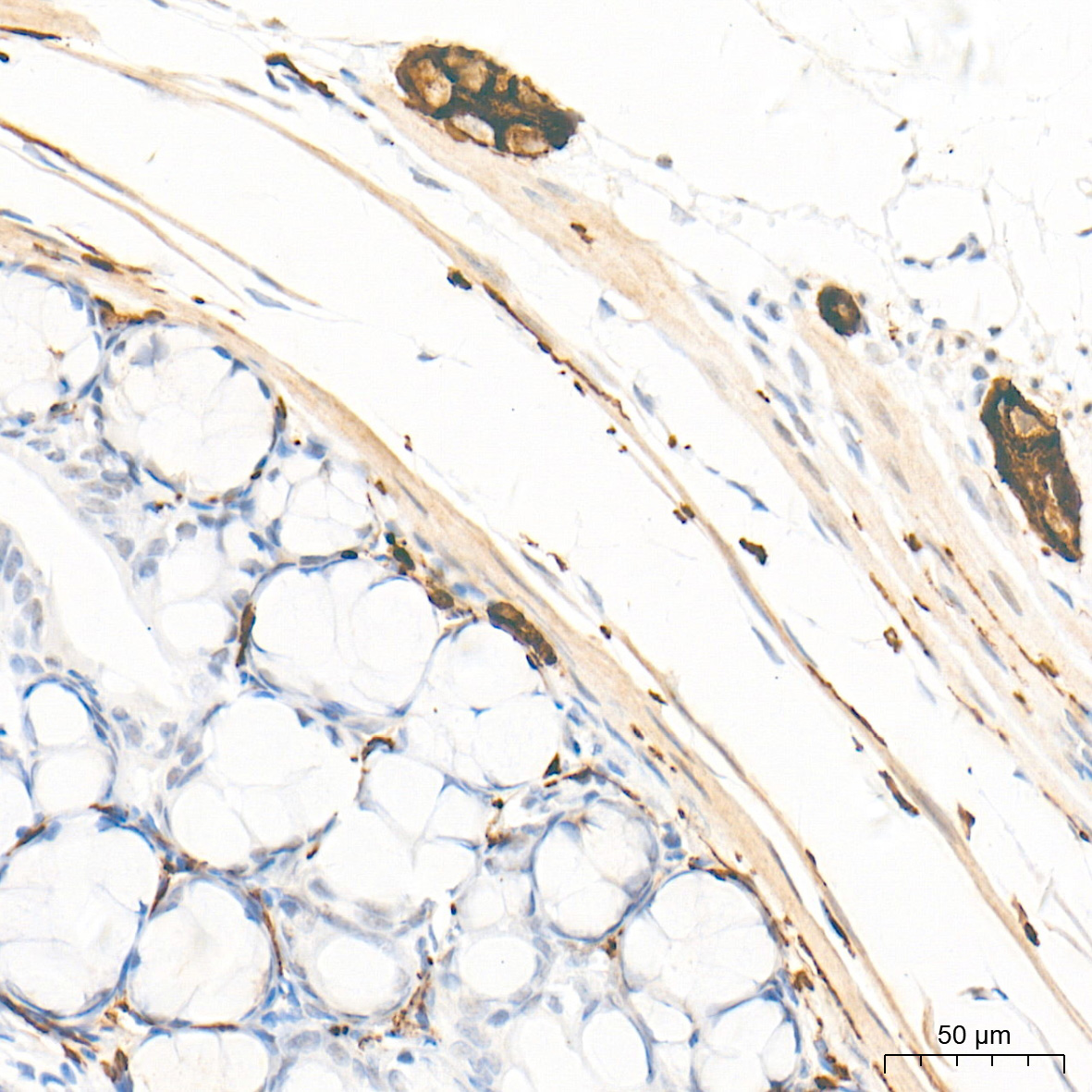 GAP43 Rabbit mAb
