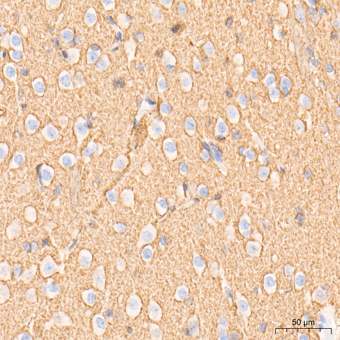 GAP43 Rabbit mAb