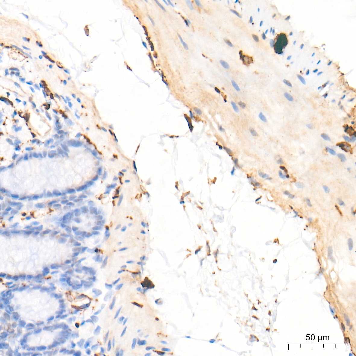 GAP43 Rabbit mAb