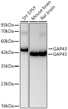 GAP43 Rabbit mAb
